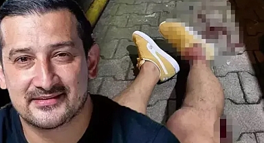 SERHAT AKIN'A SİLAHLI SALDIRIDA 2 KİŞİ YAKALANDI